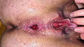 Gaping ass, big clit jerking