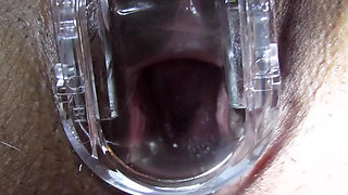 Cum Cervix Insemination
