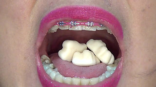 Swallowing Lots of Gummi Bears at Same Time!!