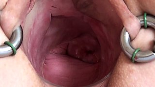 Real Cervix Fucking Insertion Objects in Uterus